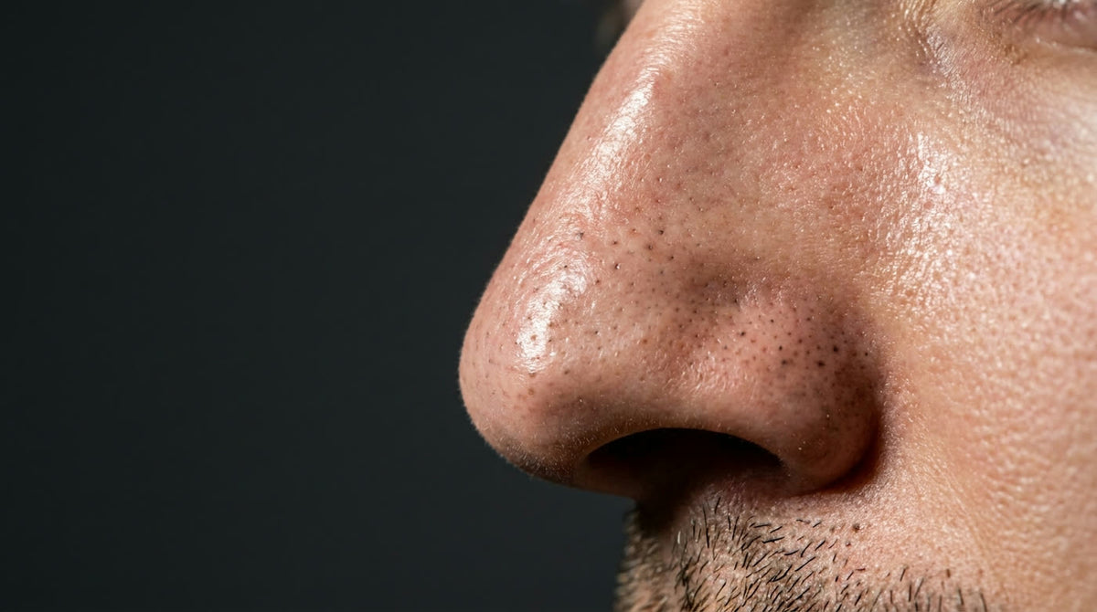 Macro photograph of a man's nose showing blackheads and enlarged pores